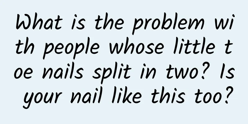 What is the problem with people whose little toe nails split in two? Is your nail like this too?