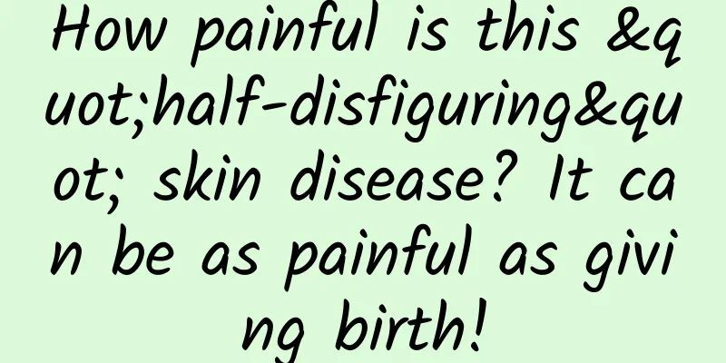 How painful is this "half-disfiguring" skin disease? It can be as painful as giving birth!